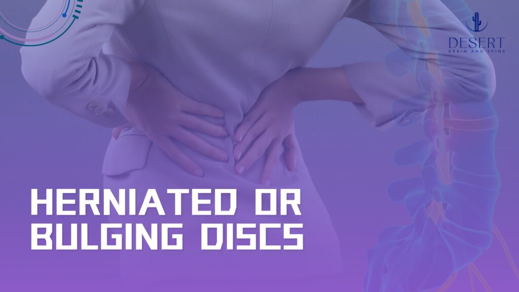 Herniated or Bulging Discs